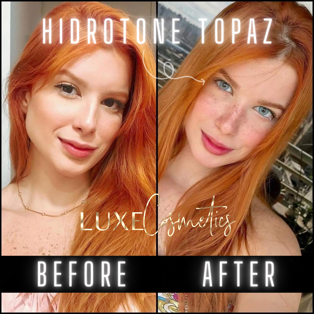 Hidrotone Topaz